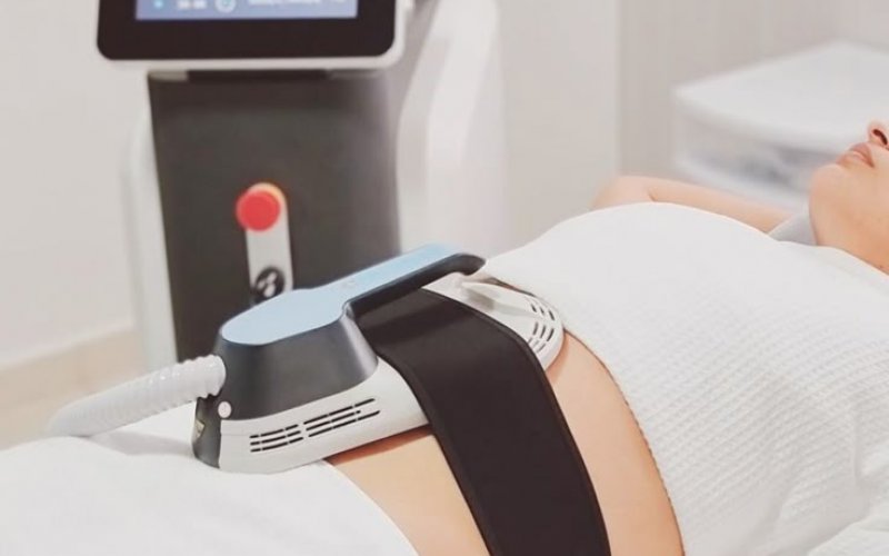 Samsun’da Bölgesel İncelme ile Ameliyatsız Zayıflama Çözümleri